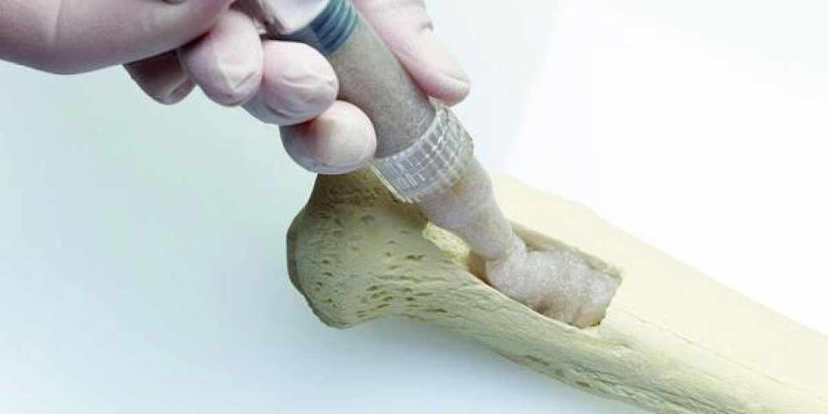 Bone Grafts and Substitutes Market 2031: Opportunities, Trends, and Comprehensive Analysis